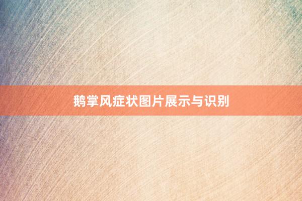 鹅掌风症状图片展示与识别